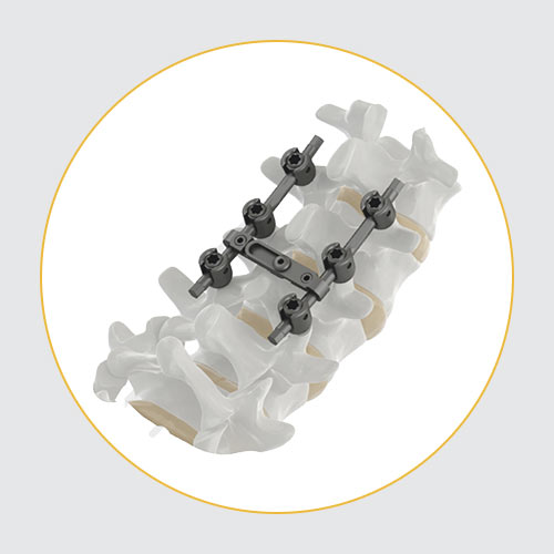 Spine Surgery - Manufacturer and supplier of orthopaedic implants