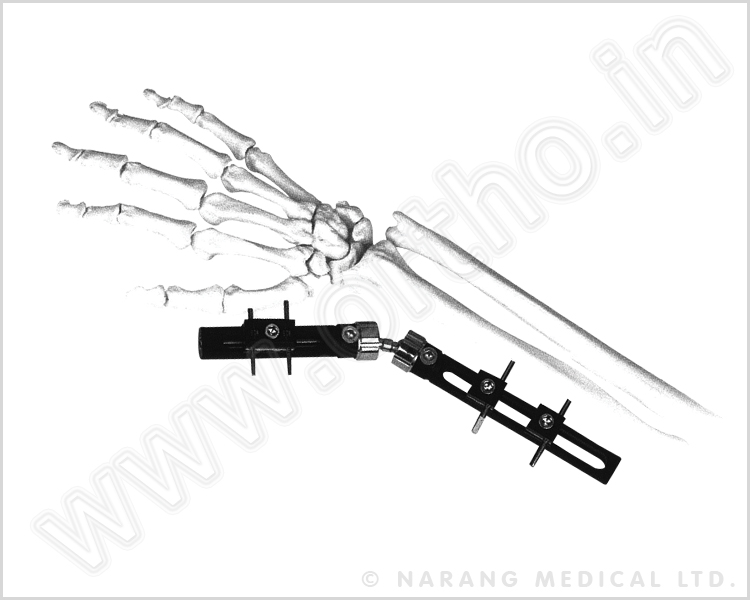  Dynamic Wrist External Fixator - Type A