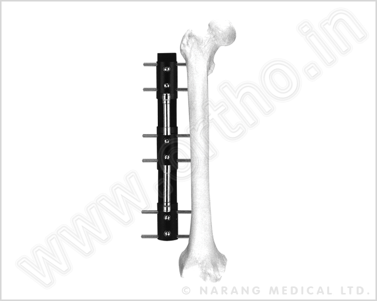 Bone Lengthening Fixator - Type A