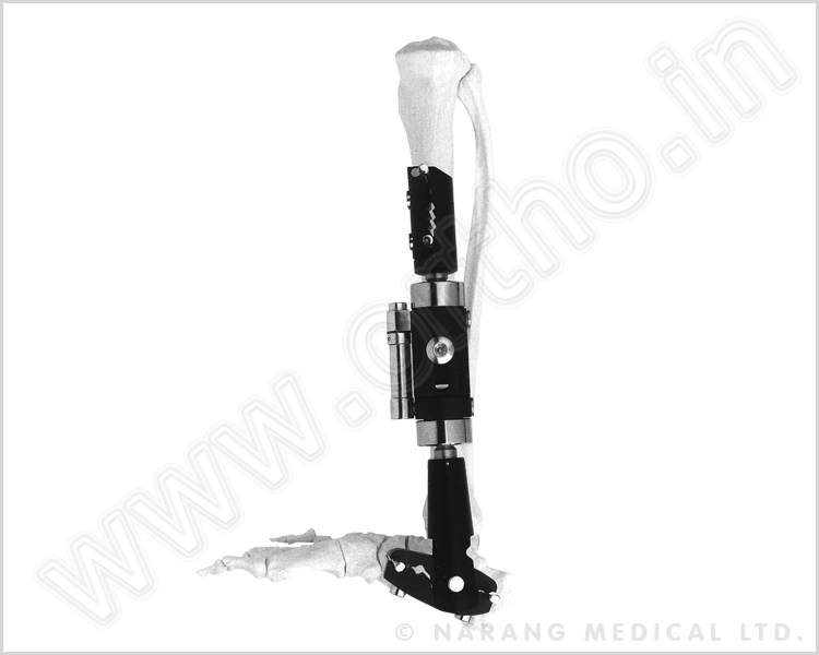 Dynamic Axial Fixator (Ankle Joint Type) - Small