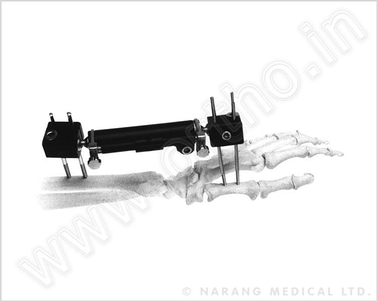 Wrist External Fixator (Radiolucent Design)
