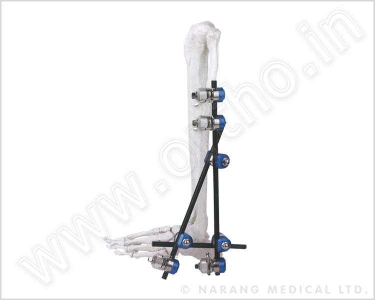 Q.5260    Ankle Joint Fixator