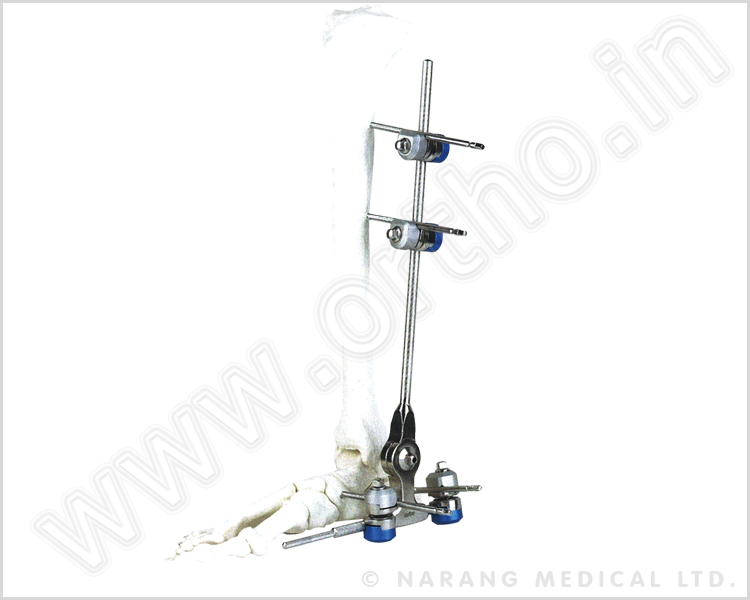 Q.5280 &nbsp;&nbsp; Ankle Joint Fixator