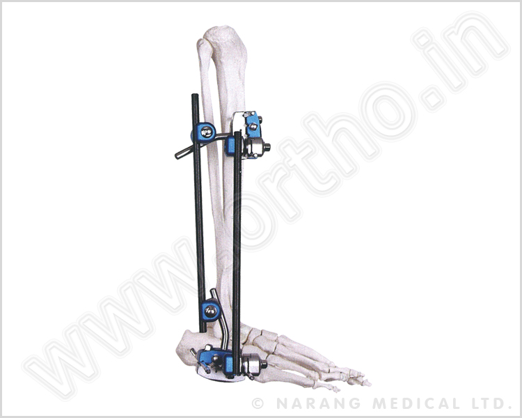 Q.5300    Ankle Fusion Joint Fixator	
