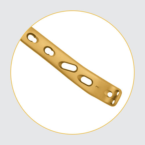 Ankle Fusion Safety Lock Plate