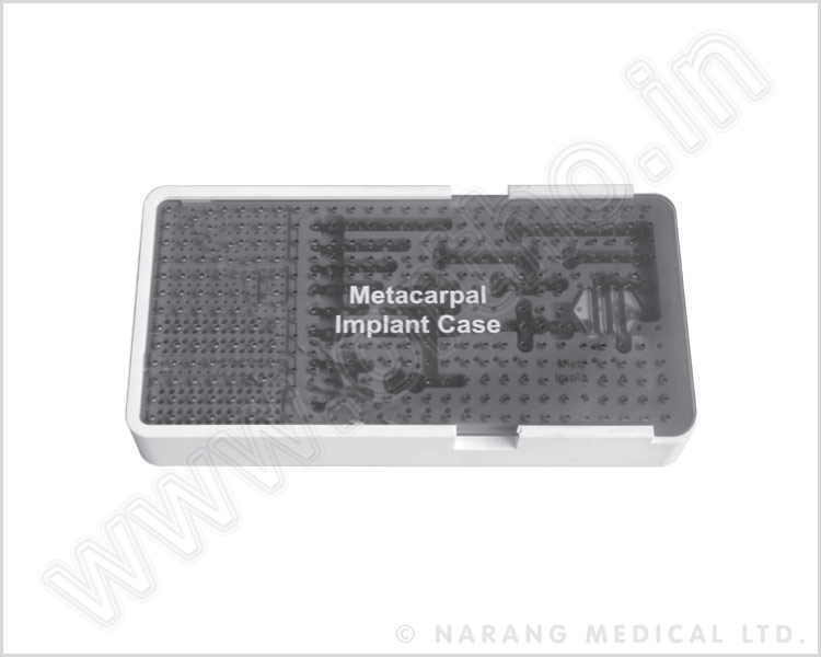 Metacarpal Implant Case